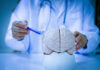 A doctor pointing at a brain model with a pen